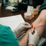 Vitamine B12 prise de sang : prélèvement à jeun et taux normal